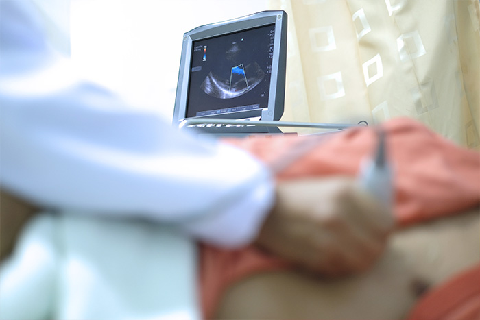echocardiographie